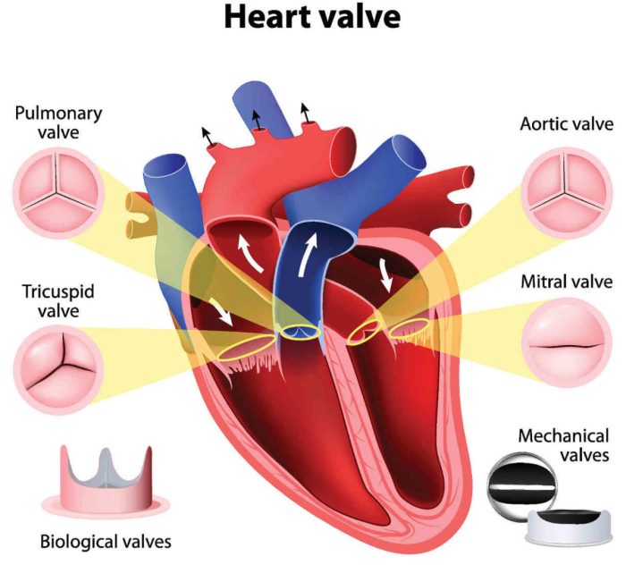 Valve aortic heart disease mitral surgery tavr anatomy bicuspid valves replacement repair cardiac tavi vs survey treatment manchester biological severe